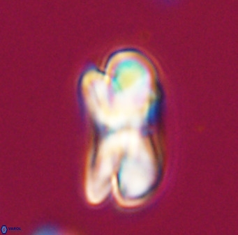 Bicolumnus scrippsae VR 33527