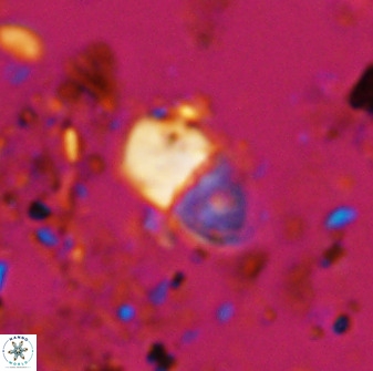 Bifidalithus geminicatillus 33554