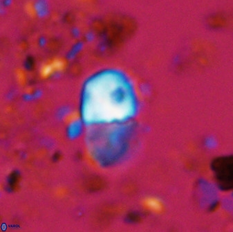 Bifidalithus geminicatillus 33555