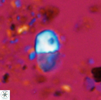 Bifidalithus geminicatillus 33555