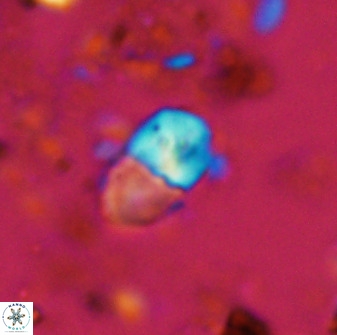 Bifidalithus geminicatillus 33556