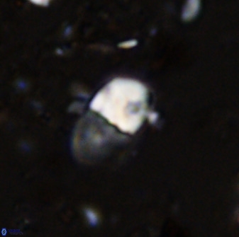 Bifidalithus geminicatillus 33557