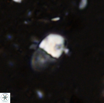 Bifidalithus geminicatillus 33557