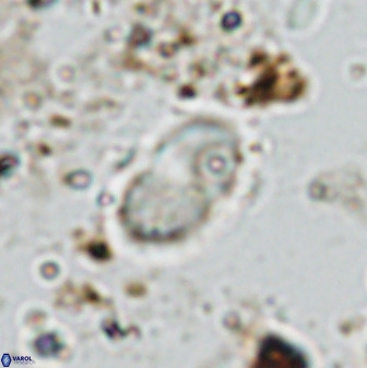 Bifidalithus geminicatillus 33558