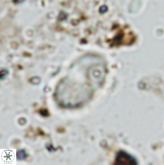 Bifidalithus geminicatillus 33558