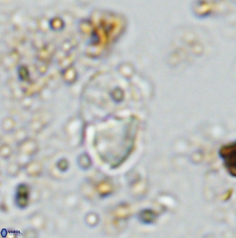 Bifidalithus geminicatillus 33559