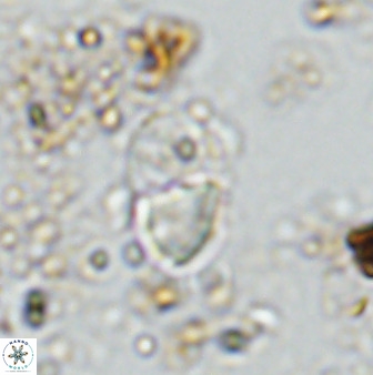 Bifidalithus geminicatillus 33559