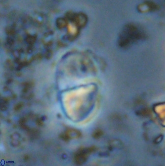 Bifidalithus geminicatillus 33560