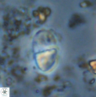 Bifidalithus geminicatillus 33560
