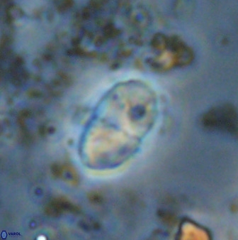 Bifidalithus geminicatillus 33561