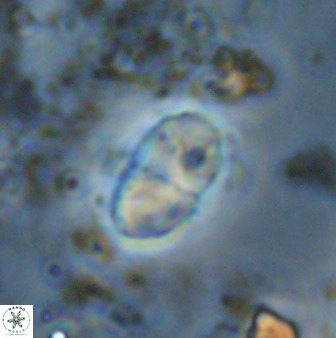 Bifidalithus geminicatillus 33561