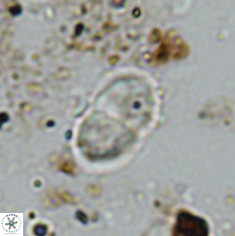 Bifidalithus geminicatillus 33562
