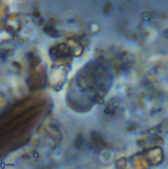 Bifidalithus geminicatillus 33563