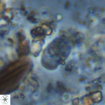 Bifidalithus geminicatillus 33563
