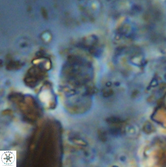 Bifidalithus geminicatillus 33564