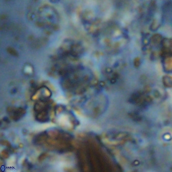 Bifidalithus geminicatillus 33565