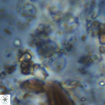 Bifidalithus geminicatillus 33565