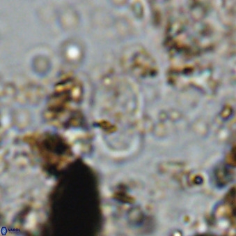 Bifidalithus geminicatillus 33566