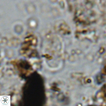Bifidalithus geminicatillus 33566
