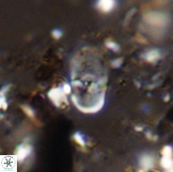 Bifidalithus geminicatillus 33567