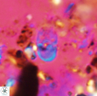 Bifidalithus geminicatillus 33568