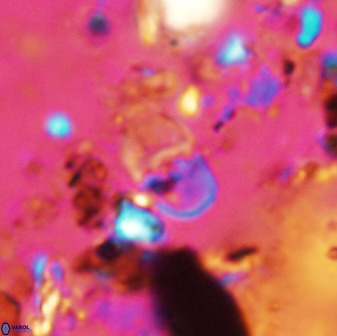 Bifidalithus geminicatillus 33569