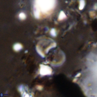 Bifidalithus geminicatillus 33570