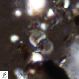 Bifidalithus geminicatillus 33570