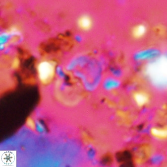 Bifidalithus geminicatillus 33572