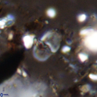 Bifidalithus geminicatillus 33573