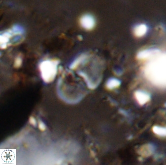 Bifidalithus geminicatillus 33573