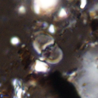 Bifidalithus geminicatillus 33574