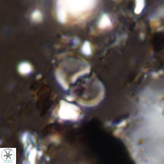 Bifidalithus geminicatillus 33574