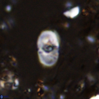 Bifidalithus geminicatillus 33652