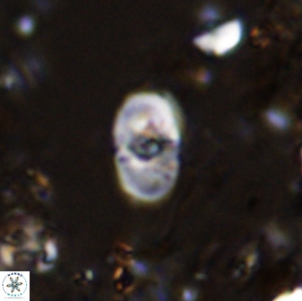 Bifidalithus geminicatillus 33652