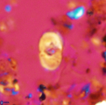 Bifidalithus geminicatillus 33653