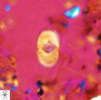Bifidalithus geminicatillus 33653