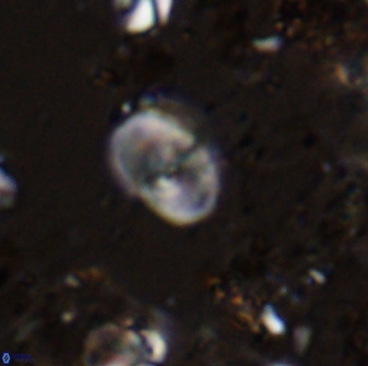 Bifidalithus geminicatillus 33654