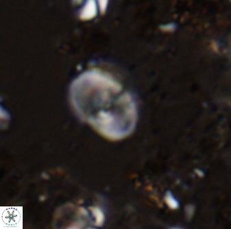 Bifidalithus geminicatillus 33654