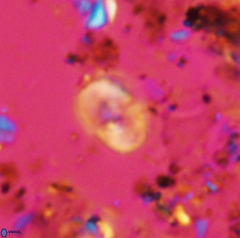 Bifidalithus geminicatillus 33655