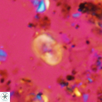 Bifidalithus geminicatillus 33655