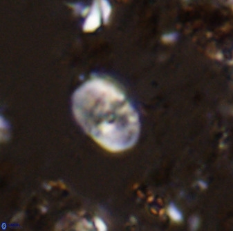 Bifidalithus geminicatillus 33656