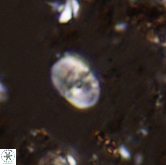 Bifidalithus geminicatillus 33656