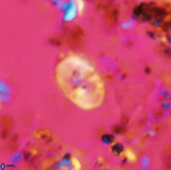 Bifidalithus geminicatillus 33657