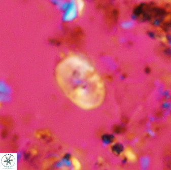 Bifidalithus geminicatillus 33657