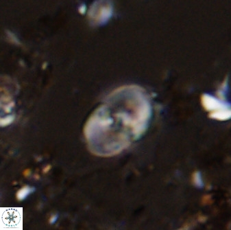 Bifidalithus geminicatillus 33658
