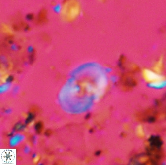Bifidalithus geminicatillus 33659