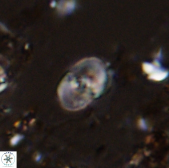 Bifidalithus geminicatillus 33660