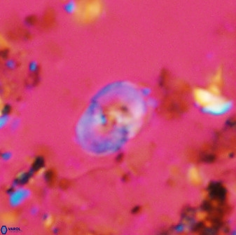 Bifidalithus geminicatillus 33661