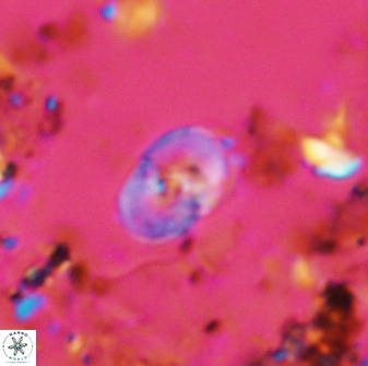 Bifidalithus geminicatillus 33661